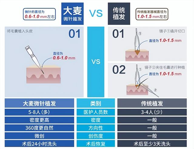 加盟种植头发在哪里进货,加盟种植头发在哪里进货的